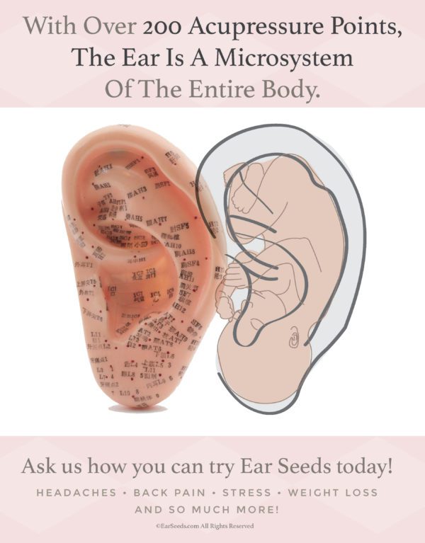 Ear Seeds - Image 4