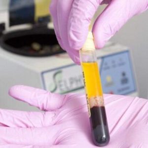 Level 6 Certificate in Platelet Rich Plasma Therapy