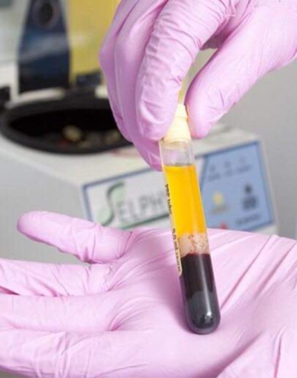 Level 6 Certificate in Platelet Rich Plasma Therapy