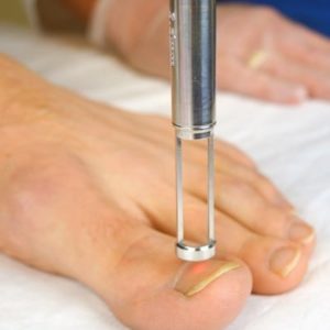 Fungal Nail Removal via Laser CPD Training